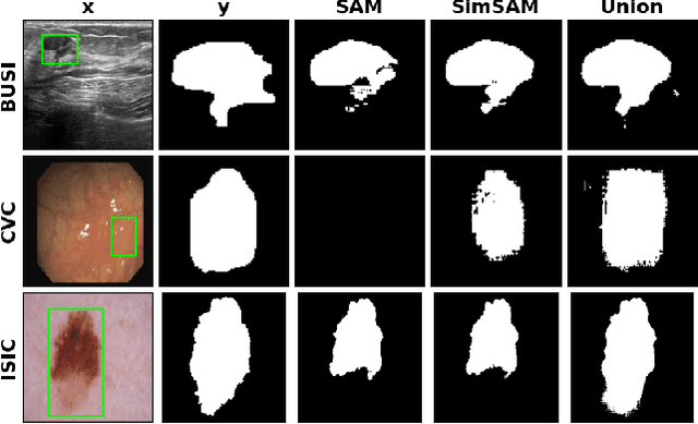 Figure 3 for SimSAM: Zero-shot Medical Image Segmentation via Simulated Interaction