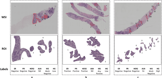 Figure 3 for Joint Stream: Malignant Region Learning for Breast Cancer Diagnosis