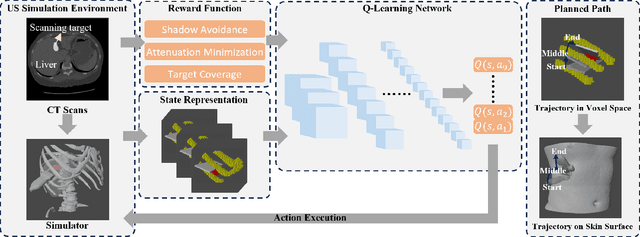 Figure 2 for Autonomous Path Planning for Intercostal Robotic Ultrasound Imaging Using Reinforcement Learning