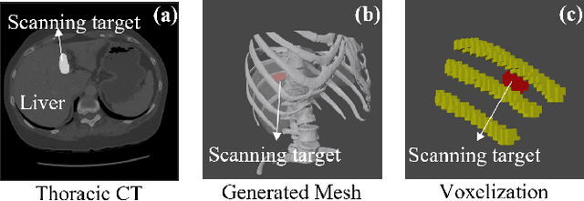 Figure 3 for Autonomous Path Planning for Intercostal Robotic Ultrasound Imaging Using Reinforcement Learning