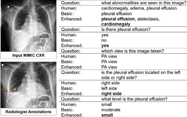 Figure 4 for D-Rax: Domain-specific Radiologic assistant leveraging multi-modal data and eXpert model predictions