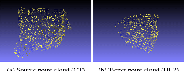 Figure 1 for Deep Learning-based Point Cloud Registration for Augmented Reality-guided Surgery