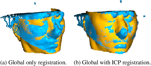 Figure 3 for Deep Learning-based Point Cloud Registration for Augmented Reality-guided Surgery