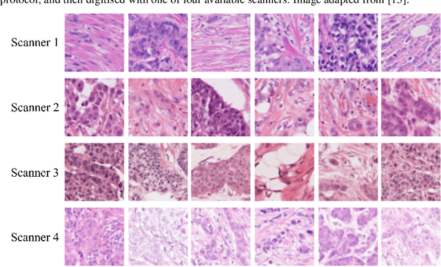 Figure 1 for Generative Adversarial Networks for Stain Normalisation in Histopathology