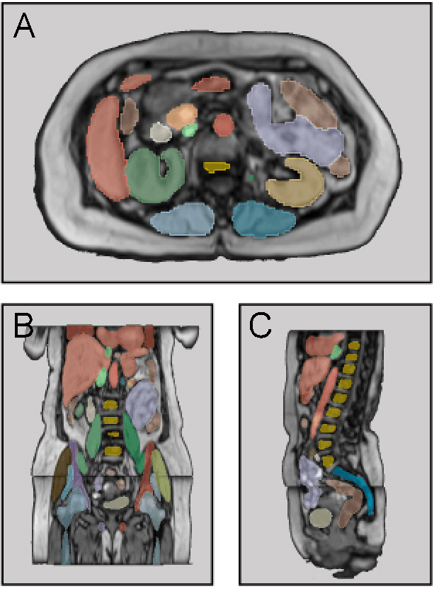 Figure 2 for MRSegmentator: Robust Multi-Modality Segmentation of 40 Classes in MRI and CT Sequences