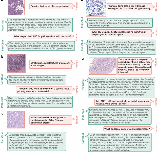 Figure 3 for A Foundational Multimodal Vision Language AI Assistant for Human Pathology