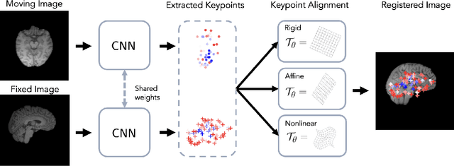 Figure 1 for BrainMorph: A Foundational Keypoint Model for Robust and Flexible Brain MRI Registration