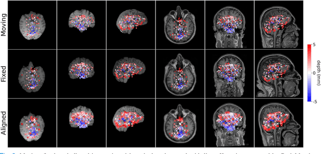 Figure 2 for BrainMorph: A Foundational Keypoint Model for Robust and Flexible Brain MRI Registration