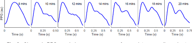 Figure 2 for Reconsideration on evaluation of machine learning models in continuous monitoring using wearables