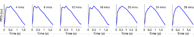 Figure 3 for Reconsideration on evaluation of machine learning models in continuous monitoring using wearables