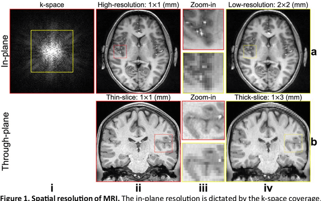 Figure 1 for Enhance the Image: Super Resolution using Artificial Intelligence in MRI
