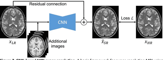 Figure 3 for Enhance the Image: Super Resolution using Artificial Intelligence in MRI