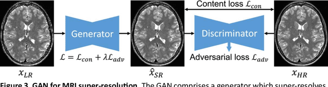 Figure 4 for Enhance the Image: Super Resolution using Artificial Intelligence in MRI