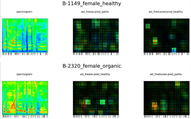 Figure 4 for Interpreting Pretrained Speech Models for Automatic Speech Assessment of Voice Disorders