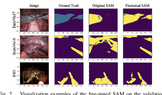 Figure 2 for Adapting SAM for Surgical Instrument Tracking and Segmentation in Endoscopic Submucosal Dissection Videos