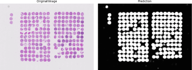 Figure 3 for TMA-Grid: An open-source, zero-footprint web application for FAIR Tissue MicroArray De-arraying