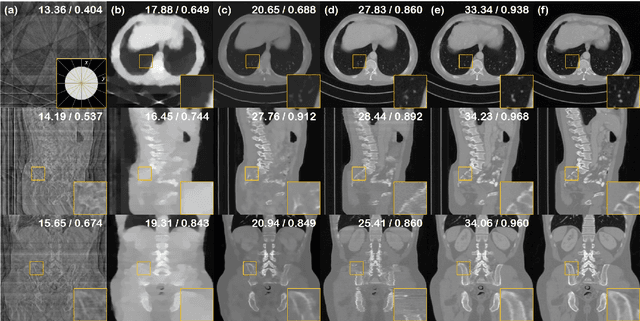 Figure 4 for Solving 3D Inverse Problems using Pre-trained 2D Diffusion Models