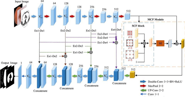 Figure 2 for Research on Intelligent Aided Diagnosis System of Medical Image Based on Computer Deep Learning