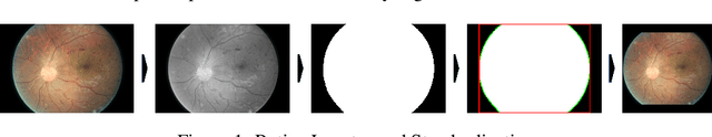 Figure 1 for Domain Agnostic Pipeline for Retina Vessel Segmentation