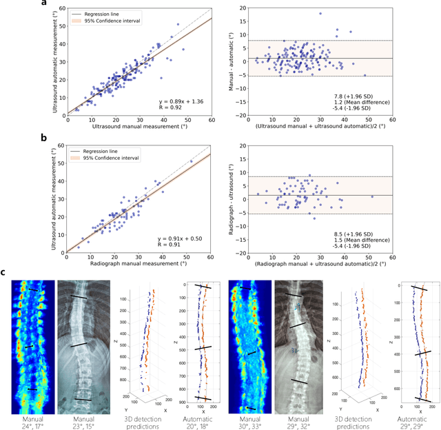 Figure 3 for Training-free image style alignment for self-adapting domain shift on handheld ultrasound devices