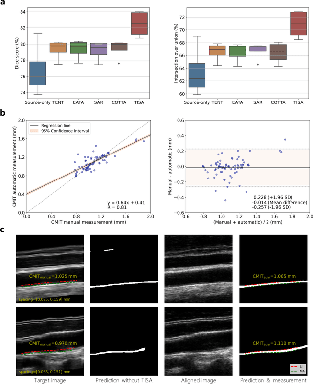 Figure 4 for Training-free image style alignment for self-adapting domain shift on handheld ultrasound devices