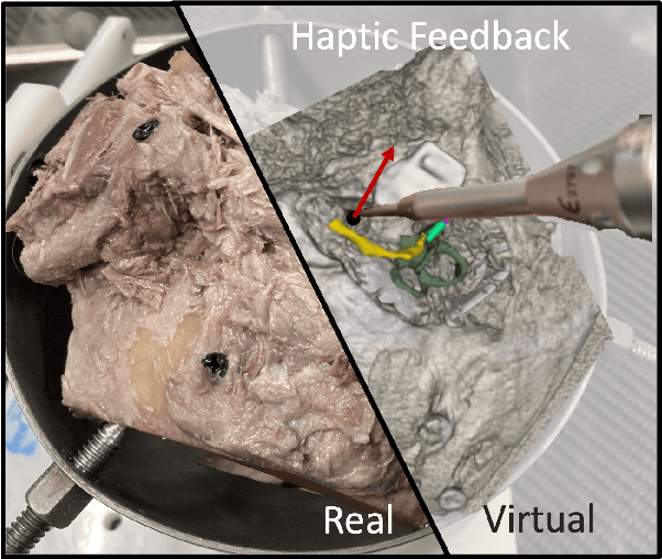 Figure 1 for Haptic-Assisted Collaborative Robot Framework for Improved Situational Awareness in Skull Base Surgery