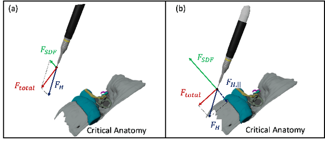 Figure 3 for Haptic-Assisted Collaborative Robot Framework for Improved Situational Awareness in Skull Base Surgery