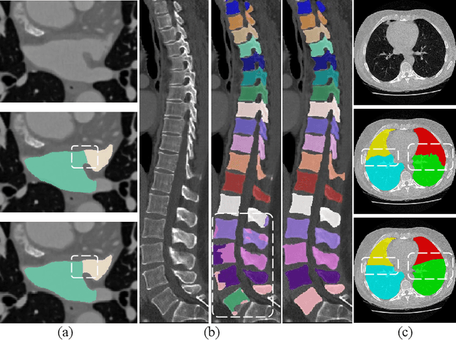 Figure 1 for PnPNet: Pull-and-Push Networks for Volumetric Segmentation with Boundary Confusion