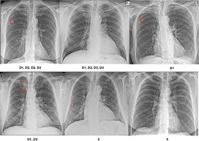 Figure 3 for Nodule detection and generation on chest X-rays: NODE21 Challenge