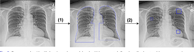 Figure 2 for Nodule detection and generation on chest X-rays: NODE21 Challenge