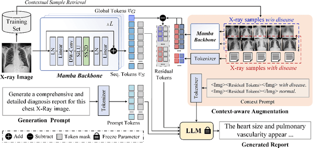 Figure 3 for R2GenCSR: Retrieving Context Samples for Large Language Model based X-ray Medical Report Generation