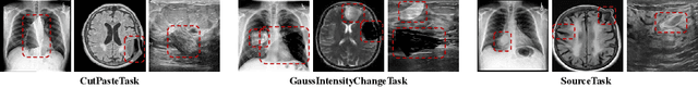 Figure 3 for MediCLIP: Adapting CLIP for Few-shot Medical Image Anomaly Detection