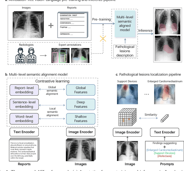 Figure 1 for Generalizable vision-language pre-training for annotation-free pathology localization