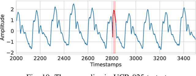 Figure 2 for Unraveling the "Anomaly" in Time Series Anomaly Detection: A Self-supervised Tri-domain Solution