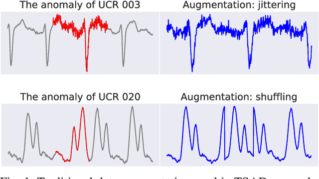 Figure 1 for Unraveling the "Anomaly" in Time Series Anomaly Detection: A Self-supervised Tri-domain Solution