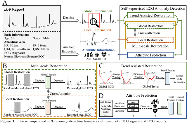 Figure 1 for Anomaly Detection in Electrocardiograms: Advancing Clinical Diagnosis Through Self-Supervised Learning