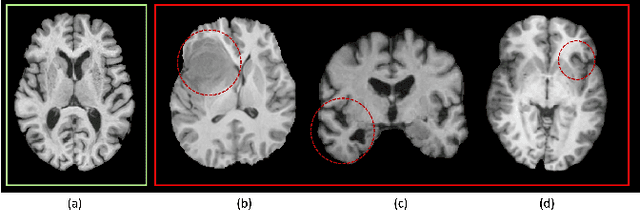 Figure 1 for Symmetry Awareness Encoded Deep Learning Framework for Brain Imaging Analysis