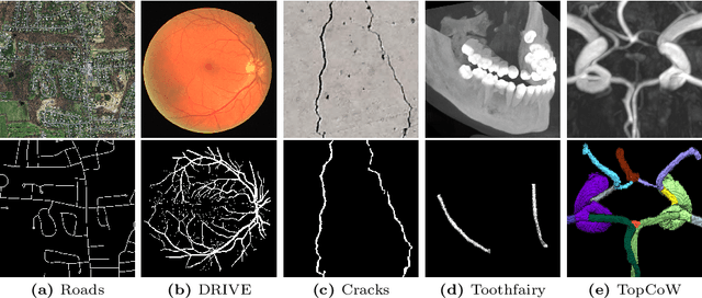 Figure 1 for Skeleton Recall Loss for Connectivity Conserving and Resource Efficient Segmentation of Thin Tubular Structures