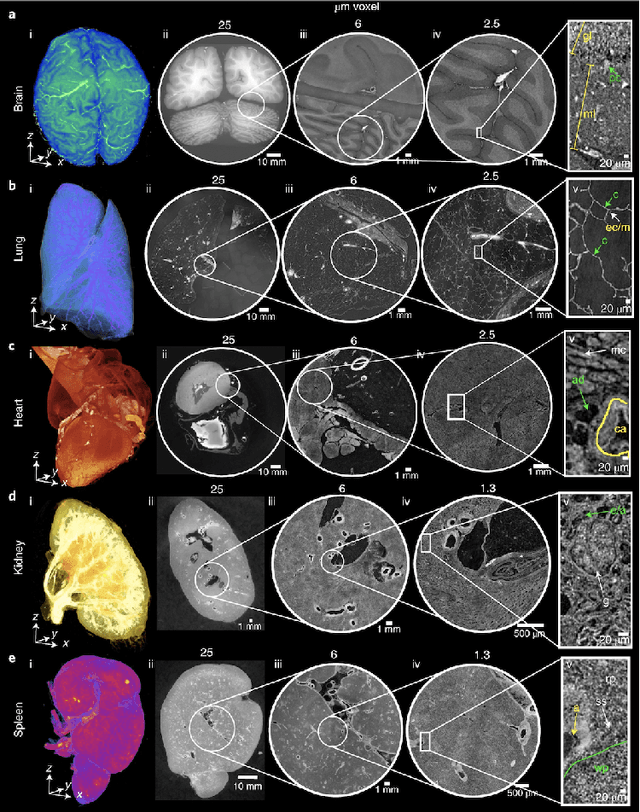 Figure 1 for Deep Learning for Vascular Segmentation and Applications in Phase Contrast Tomography Imaging