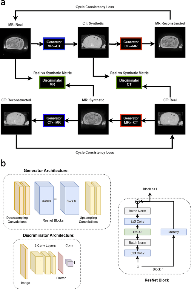 Figure 3 for Cycle-consistent Generative Adversarial Network Synthetic CT for MR-only Adaptive Radiation Therapy on MR-Linac