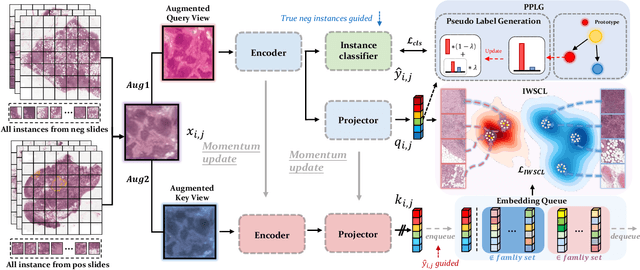 Figure 3 for Rethinking Multiple Instance Learning for Whole Slide Image Classification: A Good Instance Classifier is All You Need