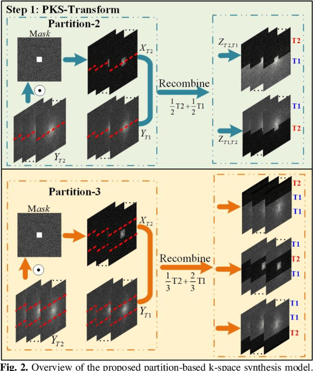 Figure 2 for Partition-based K-space Synthesis for Multi-contrast Parallel Imaging