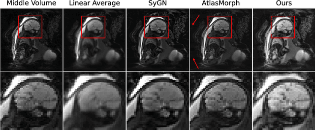 Figure 3 for Dynamic Neural Fields for Learning Atlases of 4D Fetal MRI Time-series