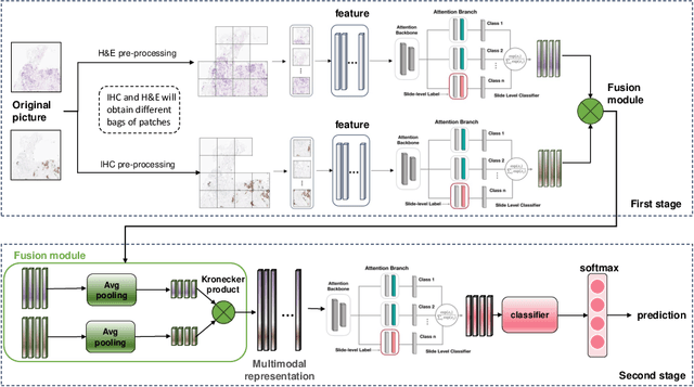 Figure 1 for IHC Matters: Incorporating IHC analysis to H&E Whole Slide Image Analysis for Improved Cancer Grading via Two-stage Multimodal Bilinear Pooling Fusion