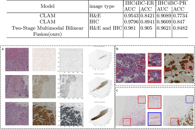 Figure 3 for IHC Matters: Incorporating IHC analysis to H&E Whole Slide Image Analysis for Improved Cancer Grading via Two-stage Multimodal Bilinear Pooling Fusion