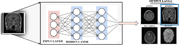 Figure 1 for Optimizing Brain Tumor Classification: A Comprehensive Study on Transfer Learning and Imbalance Handling in Deep Learning Models