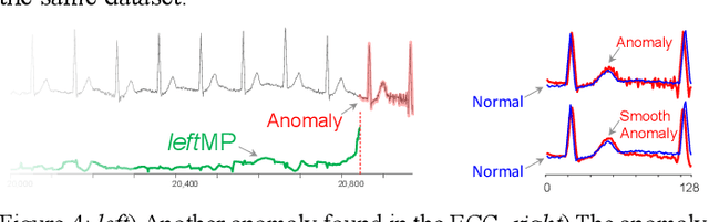 Figure 2 for PUPAE: Intuitive and Actionable Explanations for Time Series Anomalies