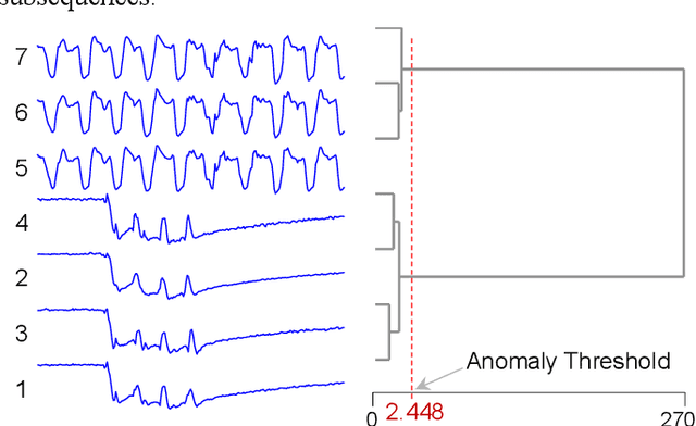 Figure 3 for PUPAE: Intuitive and Actionable Explanations for Time Series Anomalies