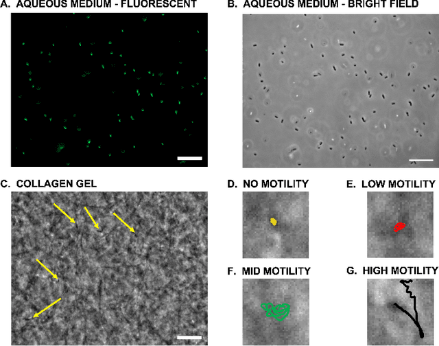 Figure 1 for MEMTRACK: A Deep Learning-Based Approach to Microrobot Tracking in Dense and Low-Contrast Environments