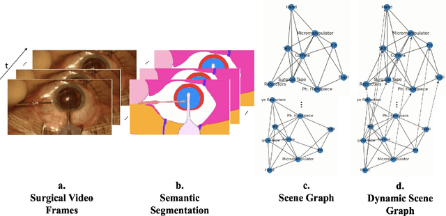Figure 1 for Dynamic Scene Graph Representation for Surgical Video